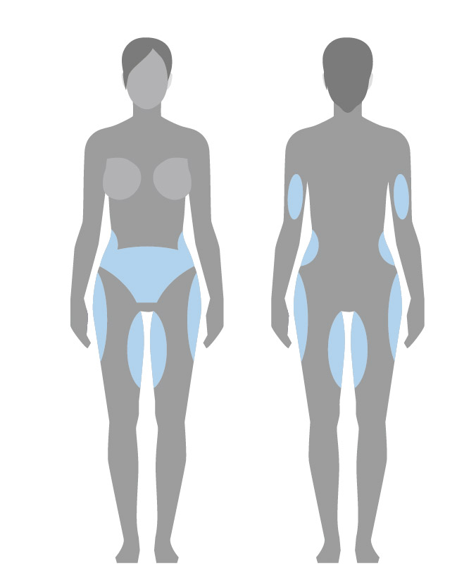 b-star-bodyforming-behandelbare-areale